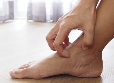 Policlínica Gipuzkoa alerta de que el riesgo de contagio del pie de atleta aumenta al caminar descalzo en duchas públicas, piscinas y vestuarios