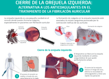 «El cierre de orejuela es una alternativa eficaz para pacientes con fibrilación auricular que no pueden tomar anticoagulantes», doctor José Ramón Rumoroso, jefe de Cardiología del Hospital Quirónsalud Bizkaia
