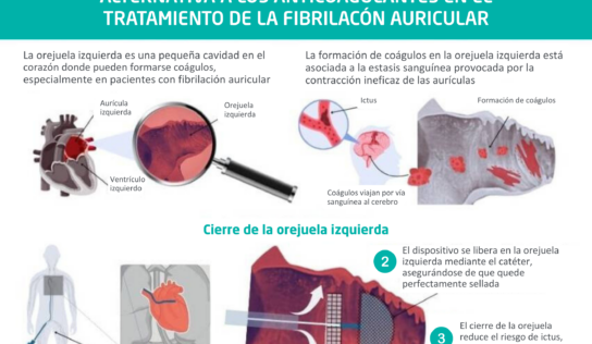 «El cierre de orejuela es una alternativa eficaz para pacientes con fibrilación auricular que no pueden tomar anticoagulantes», doctor José Ramón Rumoroso, jefe de Cardiología del Hospital Quirónsalud Bizkaia