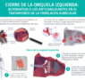 «El cierre de orejuela es una alternativa eficaz para pacientes con fibrilación auricular que no pueden tomar anticoagulantes», doctor José Ramón Rumoroso, jefe de Cardiología del Hospital Quirónsalud Bizkaia