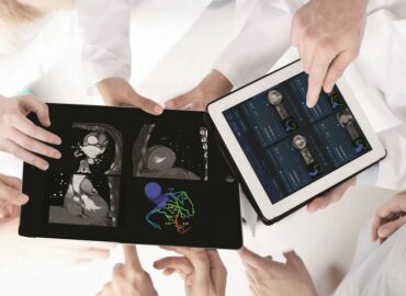 Un software con IA permite reducir en más del 60% el número de cateterismos diagnósticos innecesarios