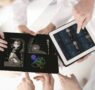 Un software con IA permite reducir en más del 60% el número de cateterismos diagnósticos innecesarios