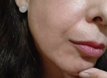 LumiDefense Advanced: protección solar inteligente con tratamiento clínico diario