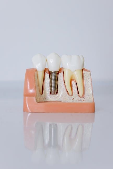 Dr. Javier Ortiz de Urbina: «El éxito de un implante dental depende en gran medida de la experiencia del profesional»