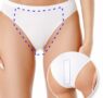 Tecnología YAG Candela facilita depilacion bikini brasileño en Kopay de Gele Giner