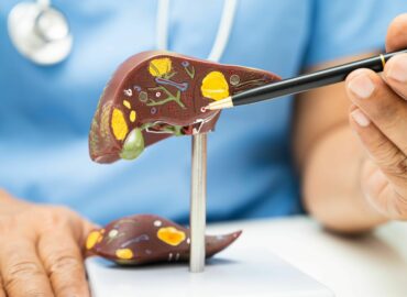 Dr. Juan Arenas, especialista en Aparato Digestivo de Policlínica Gipuzkoa: «La pérdida de peso es la clave para mejorar el hígado graso y el síndrome metabólico»