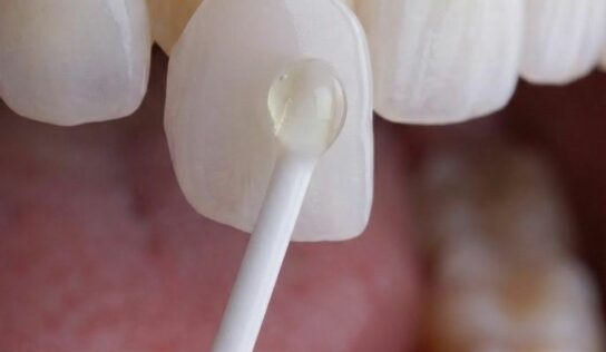 Instituto Volpe presenta Skin Finea®, carillas ultrafinas que preservan el diente propio al 100%