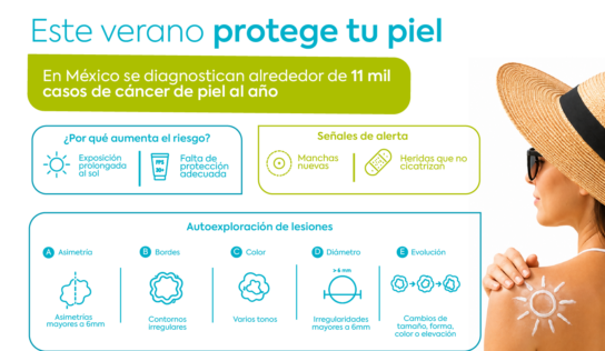 Vacaciones de verano elevan la exposición al sol y, con ello, los casos de cáncer de piel en México